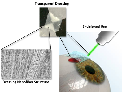 Luna’s BIOcular™ dressing consists of a unique nanofiber-reinforced hydrogel that mimics the native structure of the eye. It is easily handled, can be applied with sutures or photochemical tissue bonding, and is being designed to deliver therapeutics and antimicrobials to the ocular surface.