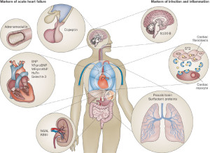 Figure 1. Biomarkers and their organ-specific release sites http://www.nature.com/nrcardio/journal/v9/n8/fig_tab/nrcardio.2012.60_F1.html