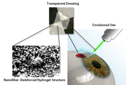 Luna’s BIOcular™ dressings consist of a unique nanofiber-reinforced hydrogel that mimics the native structure of the eye. It is easily handled, can be applied with sutures or photochemical tissue bonding, and is being designed to deliver therapeutics and antimicrobials to the ocular surface. The mechanical and biological properties of the dressing can be tailored to suit the application, with various chemistries available for targeted wound healing or structural repair.