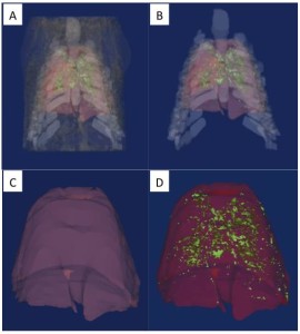 Lung scans