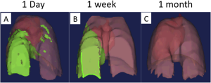 Lung injury simulation